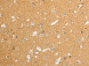 The image on the left is immunohistochemistry of paraffin-embedded Human brain tissue using CSB-PA100516 (ATP1A1 Antibody) at dilution 1/15, on the right is treated with synthetic peptide. (Original magnification: ×200)