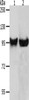 Gel: 8%SDS-PAGE, Lysate: 40 μg, Lane 1-2: HT29 cells, 231 cells, Primary antibody: CSB-PA220976 (MMP8 Antibody) at dilution 1/650, Secondary antibody: Goat anti rabbit IgG at 1/8000 dilution, Exposure time: 10 seconds