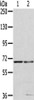 Gel: 6%SDS-PAGE, Lysate: 40 μg, Lane 1-2: 293T cells, HepG2 cells, Primary antibody: CSB-PA062333 (MMP24 Antibody) at dilution 1/200 dilution, Secondary antibody: Goat anti rabbit IgG at 1/8000 dilution, Exposure time: 40 seconds