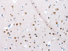 The image on the left is immunohistochemistry of paraffin-embedded Human brain tissue using CSB-PA946193 (POMC Antibody) at dilution 1/30, on the right is treated with synthetic peptide. (Original magnification: ×200)