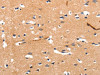 The image on the left is immunohistochemistry of paraffin-embedded Human brain tissue using CSB-PA085715 (CHRNA3 Antibody) at dilution 1/30, on the right is treated with synthetic peptide. (Original magnification: ×200)