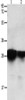 Gel: 12%SDS-PAGE, Lysate: 40 μg, Lane 1-2: Human brain malignant glioma tissue, Human laryngocarcinoma tissue, Primary antibody: CSB-PA902567 (YWHAE Antibody) at dilution 1/2200, Secondary antibody: Goat anti rabbit IgG at 1/8000 dilution, Exposure time: 30 seconds