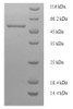 (Tris-Glycine gel) Discontinuous SDS-PAGE (reduced) with 5% enrichment gel and 15% separation gel.