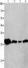 Gel: 10+12%SDS-PAGE, Lysate: 40 μg, Lane 1-4: Mouse brain tissue, A549 cells, human lymphoma tissue, hela cells, Primary antibody: CSB-PA184783 (YWHAQ Antibody) at dilution 1/950, Secondary antibody: Goat anti rabbit IgG at 1/8000 dilution, Exposure time: 1 minute