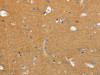 The image on the left is immunohistochemistry of paraffin-embedded Human brain tissue using CSB-PA787178 (NFASC Antibody) at dilution 1/30, on the right is treated with synthetic peptide. (Original magnification: ×200)