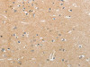 The image on the left is immunohistochemistry of paraffin-embedded Human brain tissue using CSB-PA073153 (NFASC Antibody) at dilution 1/30, on the right is treated with synthetic peptide. (Original magnification: ×200)