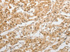 The image on the left is immunohistochemistry of paraffin-embedded Human lung cancer tissue using CSB-PA244200 (GRIN2C Antibody) at dilution 1/100, on the right is treated with synthetic peptide. (Original magnification: ×200)
