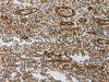 The image on the left is immunohistochemistry of paraffin-embedded Human tonsil tissue using CSB-PA982317 (PECAM1 Antibody) at dilution 1/30, on the right is treated with synthetic peptide. (Original magnification: ×200) The image on the left is immunohistochemistry of paraffin-embedded Human tonsil tissue using CSB-PA982317 (PECAM1 Antibody) at dilution 1/30, on the right is treated with synthetic peptide. (Original magnification: ×200)