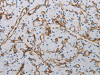 The image on the left is immunohistochemistry of paraffin-embedded Human renal cancer tissue using CSB-PA929097 (PECAM1 Antibody) at dilution 1/40, on the right is treated with synthetic peptide. (Original magnification: ×200)