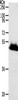 Gel: 10%SDS-PAGE, Lysate: 40 μg, Lane: Human liver cancer tissue, Primary antibody: CSB-PA998451 (RBMS3 Antibody) at dilution 1/1000, Secondary antibody: Goat anti rabbit IgG at 1/8000 dilution, Exposure time: 20 seconds