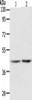 Gel: 10%SDS-PAGE, Lysate: 40 μg, Lane 1-2: Hela cells, human fetal liver tissue, Primary antibody: CSB-PA198331 (AGXT Antibody) at dilution 1/400, Secondary antibody: Goat anti rabbit IgG at 1/8000 dilution, Exposure time: 2 minutes