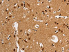 The image on the left is immunohistochemistry of paraffin-embedded Human brain tissue using CSB-PA135409 (ANAPC4 Antibody) at dilution 1/50, on the right is treated with synthetic peptide. (Original magnification: ×200)