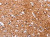 The image on the left is immunohistochemistry of paraffin-embedded Human brain tissue using CSB-PA165039 (APMAP Antibody) at dilution 1/30, on the right is treated with synthetic peptide. (Original magnification: ×200)