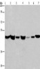 Gel: 8%SDS-PAGE, Lysate: 40 μg, Lane 1-7: Human placenta tissue, Human fetal liver tissue, PC3 cells, 231 cells, Hela cells, HepG2 cells, A549 cells, Primary antibody: CSB-PA915948 (APMAP Antibody) at dilution 1/300, Secondary antibody: Goat anti rabbit IgG at 1/8000 dilution, Exposure time: 20 seconds