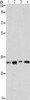 Gel: 8%SDS-PAGE, Lysate: 40 μg, Lane 1-4: 231 cells, human fetal brain tissue, NIH/3T3 cells, PC3 cells, Primary antibody: CSB-PA099883 (ARPC2 Antibody) at dilution 1/350, Secondary antibody: Goat anti rabbit IgG at 1/8000 dilution, Exposure time: 40 seconds