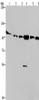 Gel: 6%SDS-PAGE, Lysate: 40 μg, Lane 1-6: Human testis tissue, K562 cells, A549 cells, Raji cells, NIH/3T3 cells, Hela cells, Primary antibody: CSB-PA145264 (PRKD3 Antibody) at dilution 1/200, Secondary antibody: Goat anti rabbit IgG at 1/8000 dilution, Exposure time: 10 minutes