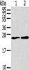 Gel: 12%SDS-PAGE, Lysate: 40 μg, Lane 1-2: Jurkat cells, PC3 cells, Primary antibody: CSB-PA438269 (ORAI1, Secondary antibody: Goat anti rabbit IgG at 1/8000 dilution, Exposure time: 10 minutes Gel: 12%SDS-PAGE, Lysate: 40 μg, Lane 1-2: Jurkat cells, PC3 cells, Primary antibody: CSB-PA438269 (ORAI1, Secondary antibody: Goat anti rabbit IgG at 1/8000 dilution, Exposure time: 10 minutes
