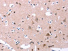 The image on the left is immunohistochemistry of paraffin-embedded Human brain tissue using CSB-PA280621 (ORAI1 Antibody) at dilution 1/25, on the right is treated with synthetic peptide. (Original magnification: ×200)