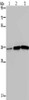 Gel: 10%SDS-PAGE, Lysate: 40 μg, Lane 1-3: Human testis tissue, A549 cells, PC3 cells, Primary antibody: CSB-PA146268 (MAGEA3 Antibody) at dilution 1/400, Secondary antibody: Goat anti rabbit IgG at 1/8000 dilution, Exposure time: 2 minutes