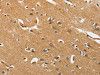 The image on the left is immunohistochemistry of paraffin-embedded Human brain tissue using CSB-PA637350 (EPHB3 Antibody) at dilution 1/40, on the right is treated with synthetic peptide. (Original magnification: ×200)