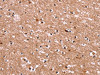 The image on the left is immunohistochemistry of paraffin-embedded Human brain tissue using CSB-PA171912 (BCL6 Antibody) at dilution 1/15, on the right is treated with synthetic peptide. (Original magnification: ×200)