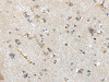 The image on the left is immunohistochemistry of paraffin-embedded Human brain tissue using CSB-PA120615 (CD63 Antibody) at dilution 1/35, on the right is treated with synthetic peptide. (Original magnification: ×200)