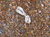 The image on the left is immunohistochemistry of paraffin-embedded Human lung cancer tissue using CSB-PA282654 (CD68 Antibody) at dilution 1/30, on the right is treated with synthetic peptide. (Original magnification: ×200)