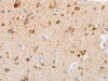 The image on the left is immunohistochemistry of paraffin-embedded Human brain tissue using CSB-PA131838 (MUC13 Antibody) at dilution 1/30, on the right is treated with synthetic peptide. (Original magnification: ×200)