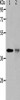 Gel: 10%SDS-PAGE, Lysate: 40 μg, Lane 1-2: NIH/3T3 cells, human fetal muscle tissue, Primary antibody: CSB-PA271046 (TRIM63 Antibody) at dilution 1/1200, Secondary antibody: Goat anti rabbit IgG at 1/8000 dilution, Exposure time: 50 seconds