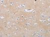 The image on the left is immunohistochemistry of paraffin-embedded Human brain tissue using CSB-PA927708 (MME Antibody) at dilution 1/85, on the right is treated with synthetic peptide. (Original magnification: ×200)