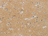 The image on the left is immunohistochemistry of paraffin-embedded Human brain tissue using CSB-PA189423 (NDRG1 Antibody) at dilution 1/70, on the right is treated with synthetic peptide. (Original magnification: ×200)