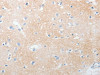 The image on the left is immunohistochemistry of paraffin-embedded Human brain tissue using CSB-PA964902 (NOTCH2 Antibody) at dilution 1/30, on the right is treated with synthetic peptide. (Original magnification: ×200)