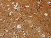 The image on the left is immunohistochemistry of paraffin-embedded Human brain tissue using CSB-PA975139 (HMGN5 Antibody) at dilution 1/25, on the right is treated with synthetic peptide. (Original magnification: ×200)