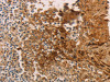 The image on the left is immunohistochemistry of paraffin-embedded Human tonsil tissue using CSB-PA207627 (ADCYAP1R1 Antibody) at dilution 1/70, on the right is treated with synthetic peptide. (Original magnification: ×200)