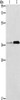 Gel: 10%SDS-PAGE, Lysate: 40 μg, Lane 1-2: 231 cells, Jurkat cells, Primary antibody: CSB-PA175450 (PAFAH2 Antibody) at dilution 1/300, Secondary antibody: Goat anti rabbit IgG at 1/8000 dilution, Exposure time: 20 seconds