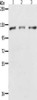 Gel: 8%SDS-PAGE, Lysate: 40 μg, Lane 1-3: Hela cells, K562 cells, Jurkat cells, Primary antibody: CSB-PA436053 (PARP1 Antibody) at dilution 1/350, Secondary antibody: Goat anti rabbit IgG at 1/8000 dilution, Exposure time: 1 second