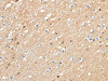 The image on the left is immunohistochemistry of paraffin-embedded Human brain tissue using CSB-PA248209 (RRAD Antibody) at dilution 1/30, on the right is treated with synthetic peptide. (Original magnification: ×200)