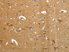 The image on the left is immunohistochemistry of paraffin-embedded Human brain tissue using CSB-PA074259 (AMD1 Antibody) at dilution 1/40, on the right is treated with synthetic peptide. (Original magnification: ×200)