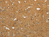 The image on the left is immunohistochemistry of paraffin-embedded Human brain tissue using CSB-PA610964 (AKAP12 Antibody) at dilution 1/40, on the right is treated with synthetic peptide. (Original magnification: ×200)
