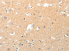 The image on the left is immunohistochemistry of paraffin-embedded Human brain tissue using CSB-PA976408 (TNXB Antibody) at dilution 1/40, on the right is treated with synthetic peptide. (Original magnification: ×200)