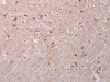The image on the left is immunohistochemistry of paraffin-embedded Human brain tissue using CSB-PA090961 (AKT2 Antibody) at dilution 1/70, on the right is treated with synthetic peptide. (Original magnification: ×200)