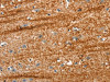 The image on the left is immunohistochemistry of paraffin-embedded Human brain tissue using CSB-PA010692 (APC Antibody) at dilution 1/25, on the right is treated with synthetic peptide. (Original magnification: ×200)