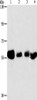 Gel: 10%SDS-PAGE, Lysate: 40 μg, Lane 1-4: Hela cells, MCF7 cells, A549 cells, Lovo cells, Primary antibody: CSB-PA042409 (API5 Antibody) at dilution 1/500, Secondary antibody: Goat anti rabbit IgG at 1/8000 dilution, Exposure time: 1 minute