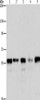 Gel: 8%SDS-PAGE, Lysate: 40 μg, Lane 1-5: Hela cells, Jurkat cells, 293T cells, K562 cells, mouse testis tissue, Primary antibody: CSB-PA240267 (ARIH2 Antibody) at dilution 1/550, Secondary antibody: Goat anti rabbit IgG at 1/8000 dilution, Exposure time: 40 seconds