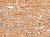 The image on the left is immunohistochemistry of paraffin-embedded Human brain tissue using CSB-PA906875 (ARHGEF11 Antibody) at dilution 1/25, on the right is treated with synthetic peptide. (Original magnification: ×200)