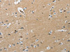 The image on the left is immunohistochemistry of paraffin-embedded Human brain tissue using CSB-PA540033 (PIP5K1C Antibody) at dilution 1/25, on the right is treated with synthetic peptide. (Original magnification: ×200)