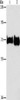 Gel: 6%SDS-PAGE, Lysate: 40 μg, Lane 1-2: Mouse liver tissue, Mouse kidney tissue, Primary antibody: CSB-PA826844 (PCK1 Antibody) at dilution 1/362.5, Secondary antibody: Goat anti rabbit IgG at 1/8000 dilution, Exposure time: 1 minute