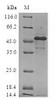 (Tris-Glycine gel) Discontinuous SDS-PAGE (reduced) with 5% enrichment gel and 15% separation gel.