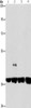 Gel: 8%SDS-PAGE, Lysate: 40 μg, Lane 1-4: 293T cells, 231 cells, U937 cells, Raji cells, Primary antibody: CSB-PA895479 (SERPINA9 Antibody) at dilution 1/350, Secondary antibody: Goat anti rabbit IgG at 1/8000 dilution, Exposure time: 10 seconds