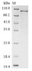 (Tris-Glycine gel) Discontinuous SDS-PAGE (reduced) with 5% enrichment gel and 15% separation gel.